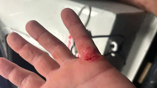 RACE, DECEMBER 02, 2024 : Photo sent from the boat HUMAN Immobilier during the Vendee Globe sailing race on December 02, 2024. (Photo by skipper Antoine Cornic)
Injury