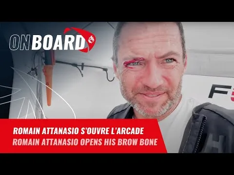 Romain Attanasio s'ouvre l'arcade | Vendée Globe 2024